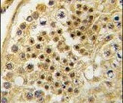 MYST2 Antibody in Immunohistochemistry (IHC)