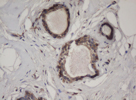 HBS1L Antibody in Immunohistochemistry (Paraffin) (IHC (P))