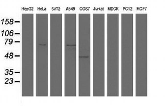 HBS1L Antibody in Western Blot (WB)