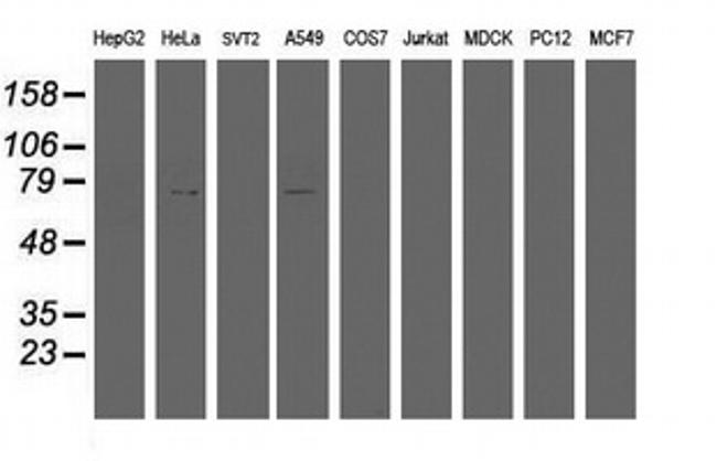 HBS1L Antibody in Western Blot (WB)