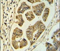 HCCS Antibody in Immunohistochemistry (IHC)
