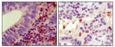 HCK Antibody in Immunohistochemistry (Paraffin) (IHC (P))