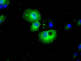 HDAC10 Antibody in Immunocytochemistry (ICC/IF)