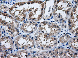 HDAC10 Antibody in Immunohistochemistry (Paraffin) (IHC (P))