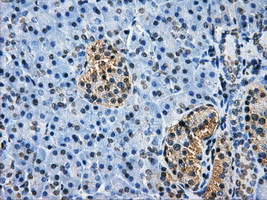 HDAC10 Antibody in Immunohistochemistry (Paraffin) (IHC (P))
