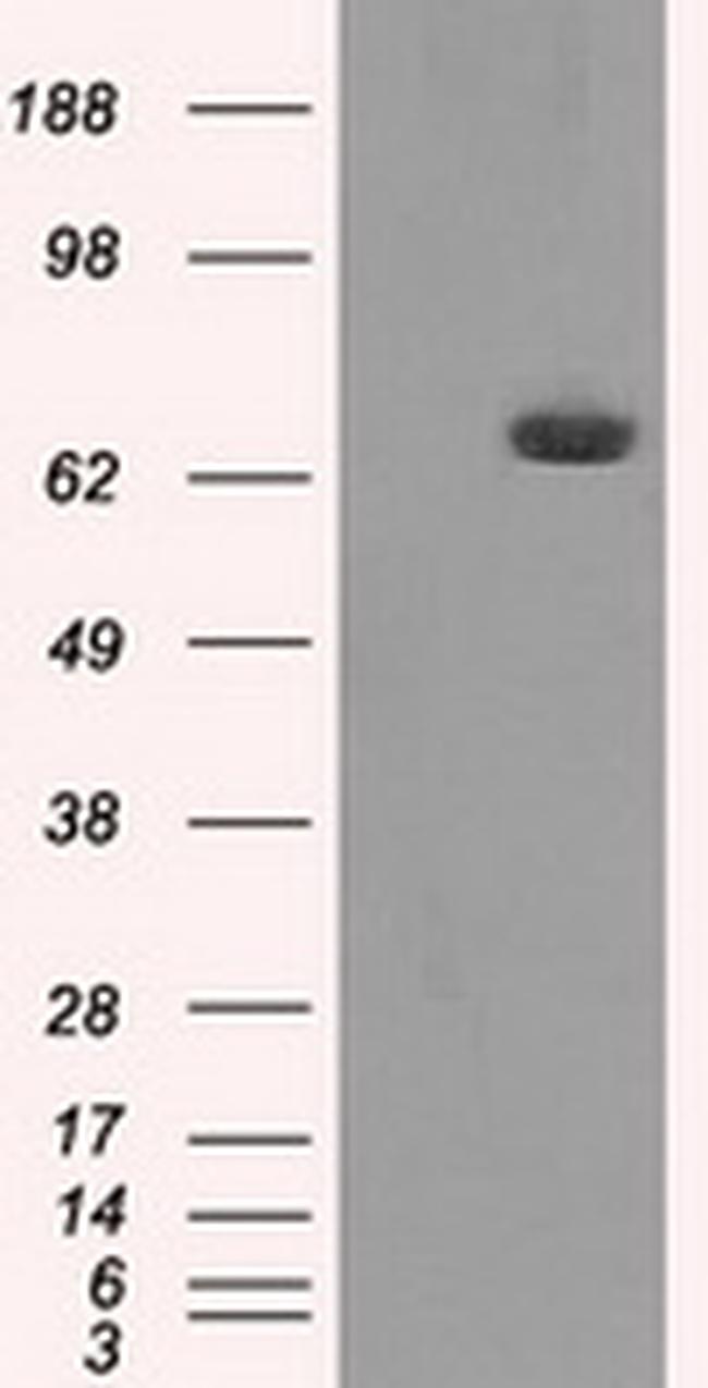 HDAC10 Antibody in Western Blot (WB)