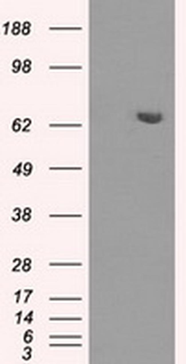 HDAC10 Antibody in Western Blot (WB)