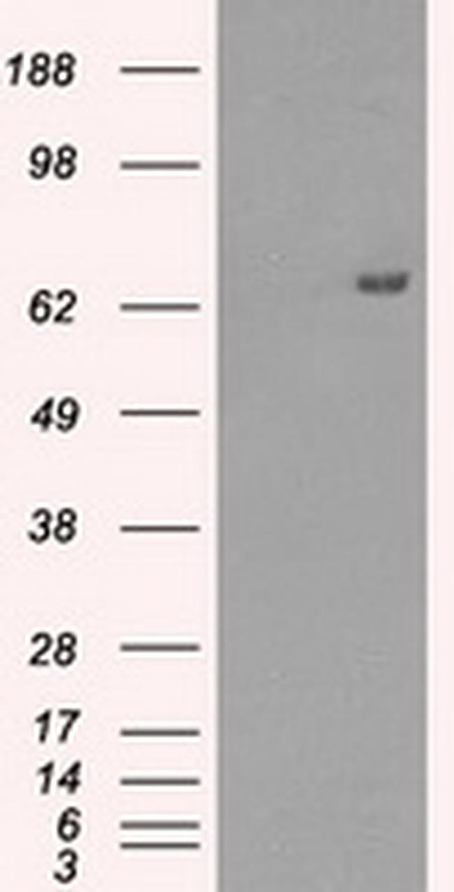HDAC10 Antibody in Western Blot (WB)