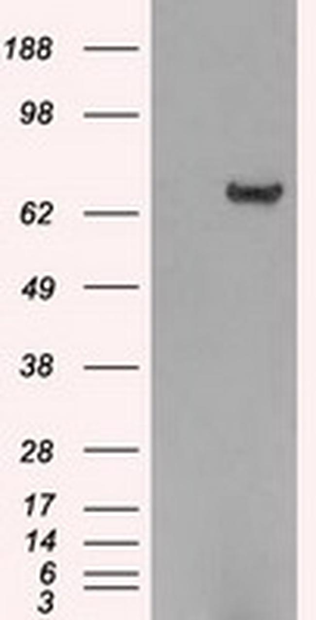 HDAC10 Antibody in Western Blot (WB)