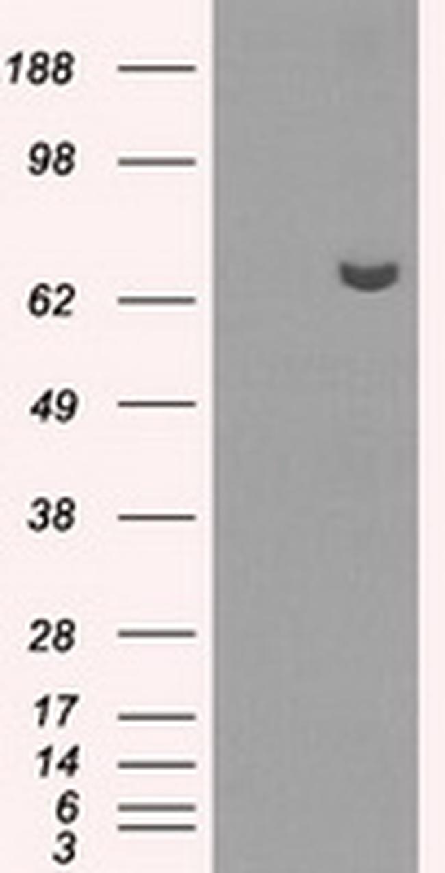 HDAC10 Antibody in Western Blot (WB)