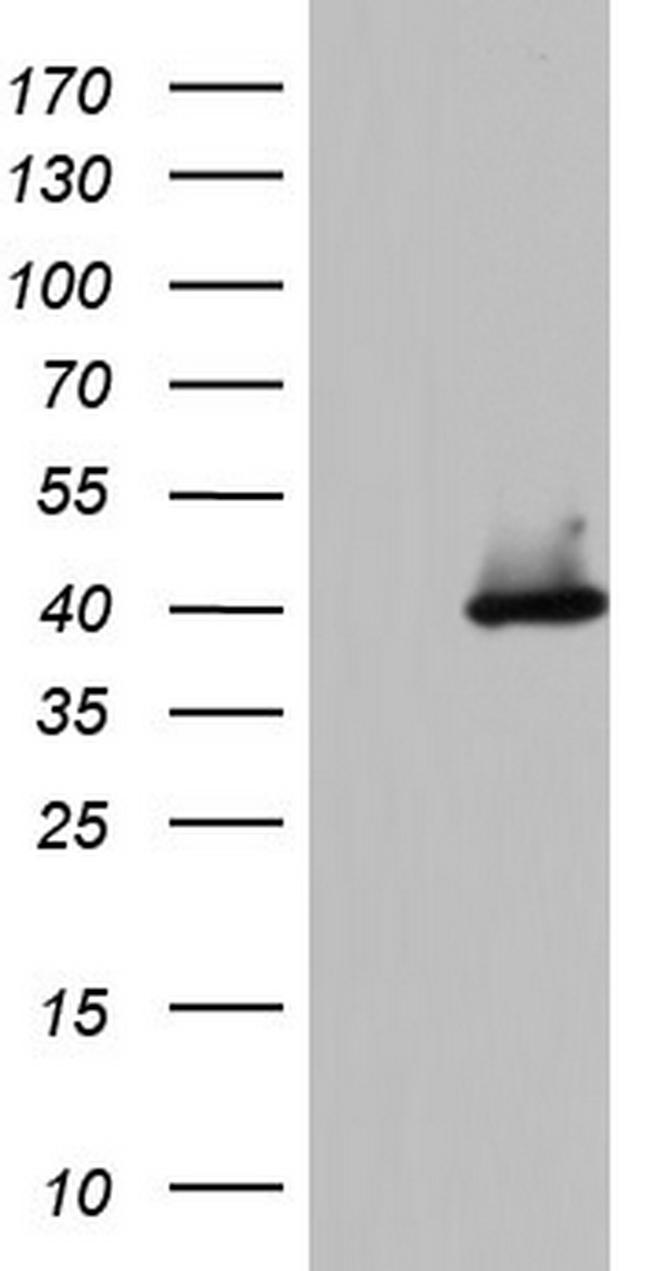 HDAC11 Antibody in Western Blot (WB)