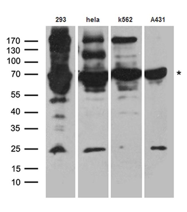 HDAC2 Antibody in Western Blot (WB)
