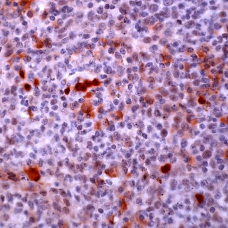 HDAC2 Antibody in Immunohistochemistry (IHC)