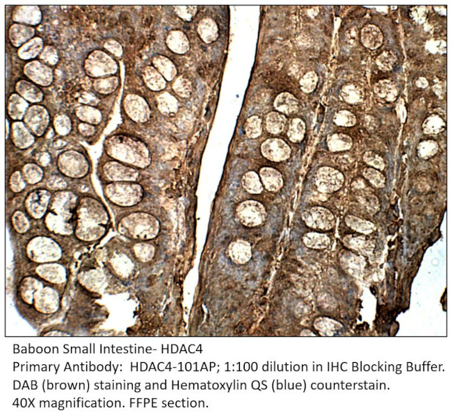 HDAC4 Antibody in Immunohistochemistry (IHC)