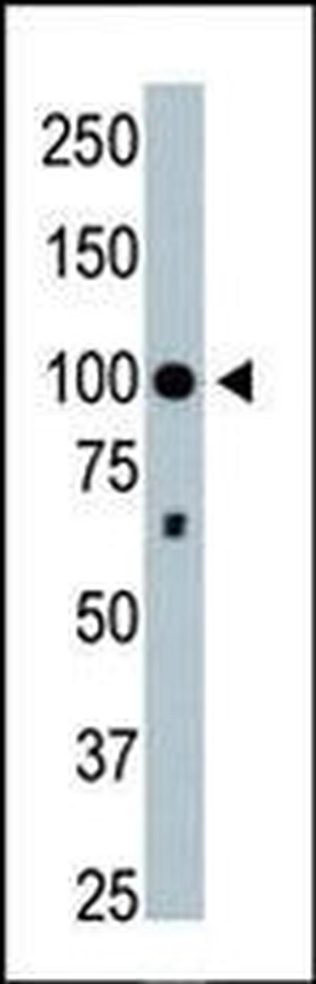 HDAC4 Antibody in Western Blot (WB)