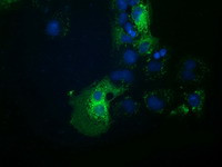 HDAC6 Antibody in Immunocytochemistry (ICC/IF)
