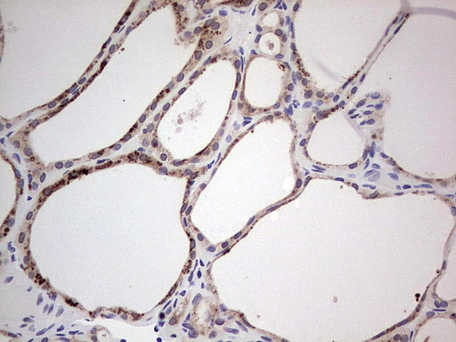 HDAC9 Antibody in Immunohistochemistry (Paraffin) (IHC (P))