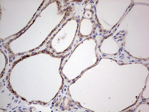 HDAC9 Antibody in Immunohistochemistry (Paraffin) (IHC (P))