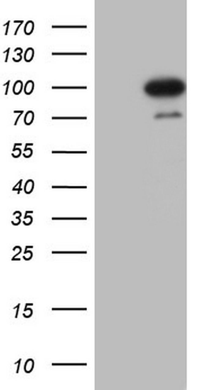 HDAC9 Antibody in Western Blot (WB)