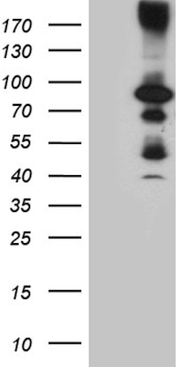 HDAC9 Antibody in Western Blot (WB)