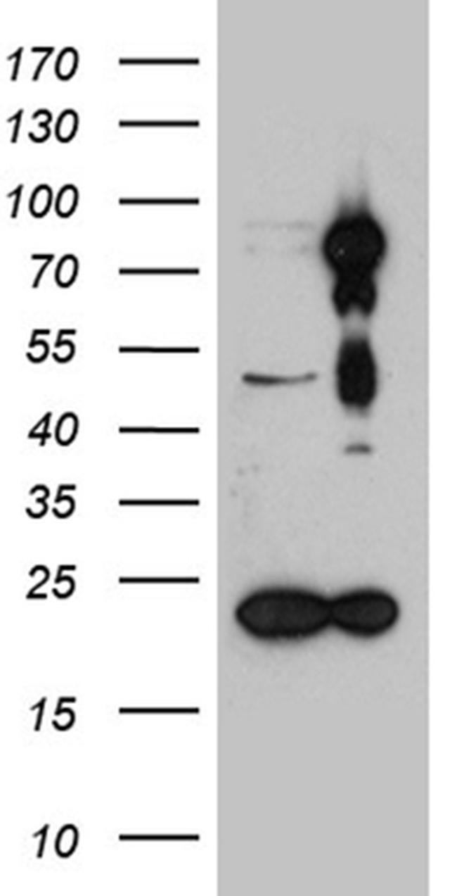 HDAC9 Antibody in Western Blot (WB)