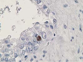 HDHD2 Antibody in Immunohistochemistry (Paraffin) (IHC (P))