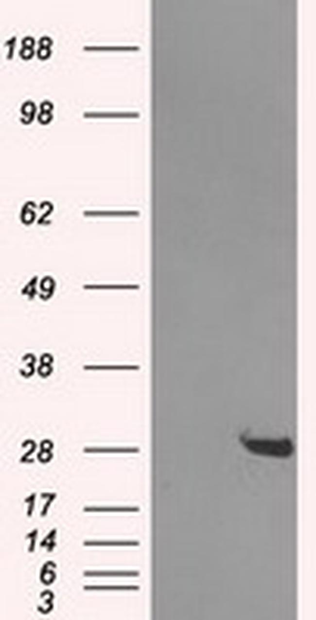 HDHD2 Antibody in Western Blot (WB)