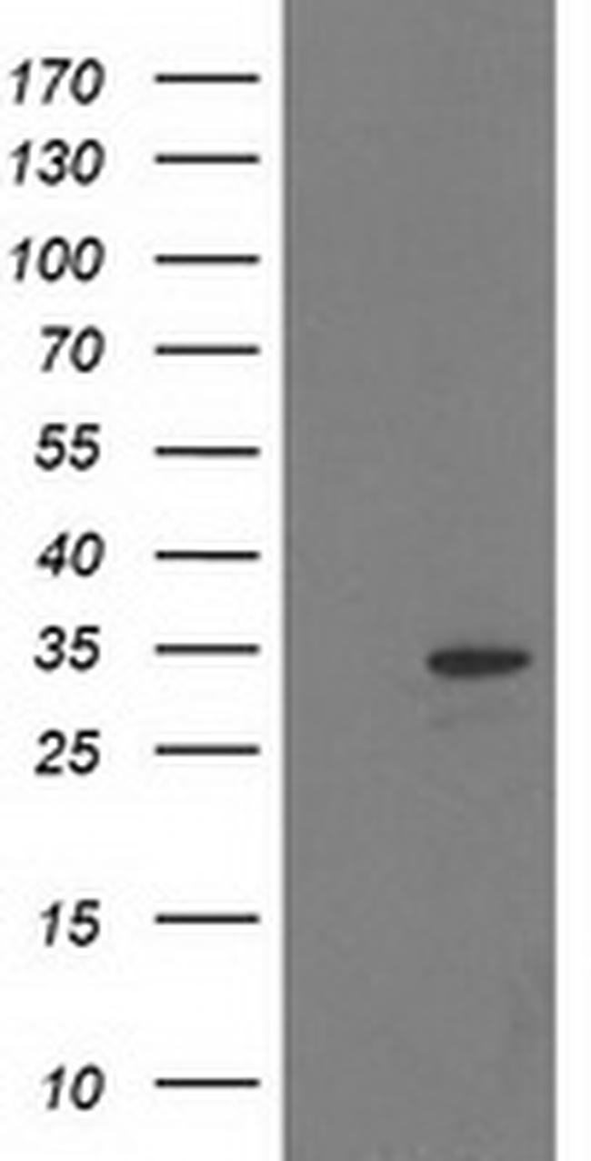 HDHD2 Antibody in Western Blot (WB)