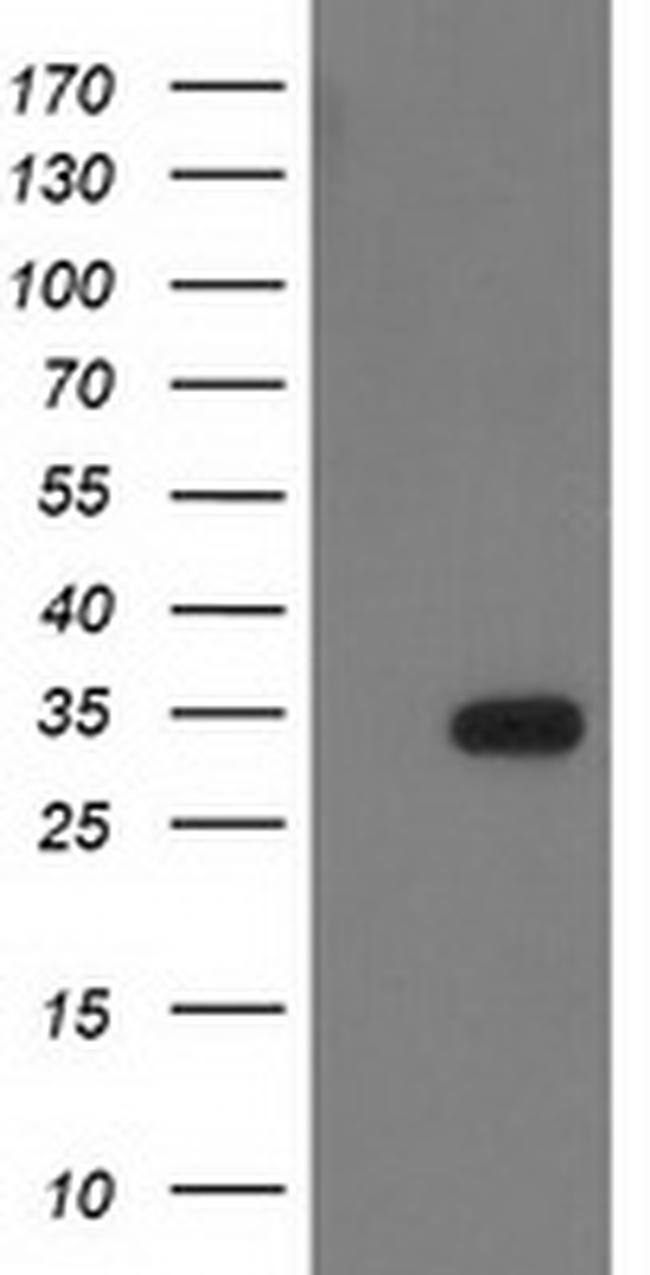HDHD2 Antibody in Western Blot (WB)