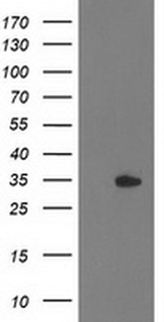 HDHD2 Antibody in Western Blot (WB)