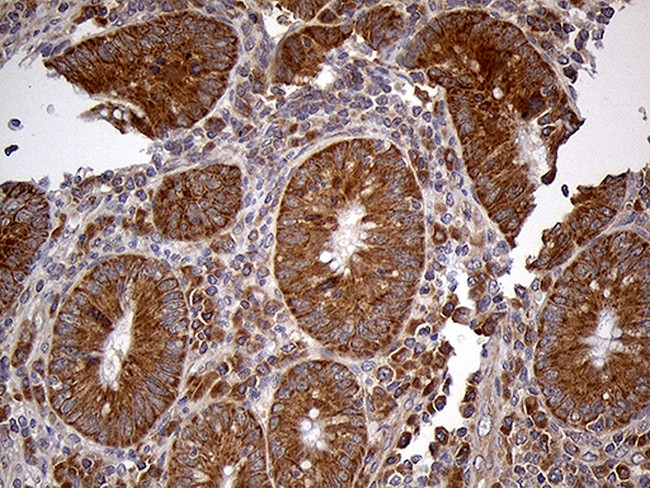 HDHD3 Antibody in Immunohistochemistry (Paraffin) (IHC (P))