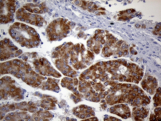 HDHD3 Antibody in Immunohistochemistry (Paraffin) (IHC (P))