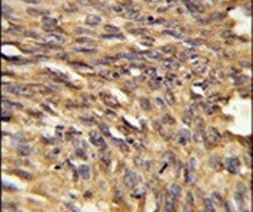 HDLBP Antibody in Immunohistochemistry (IHC)