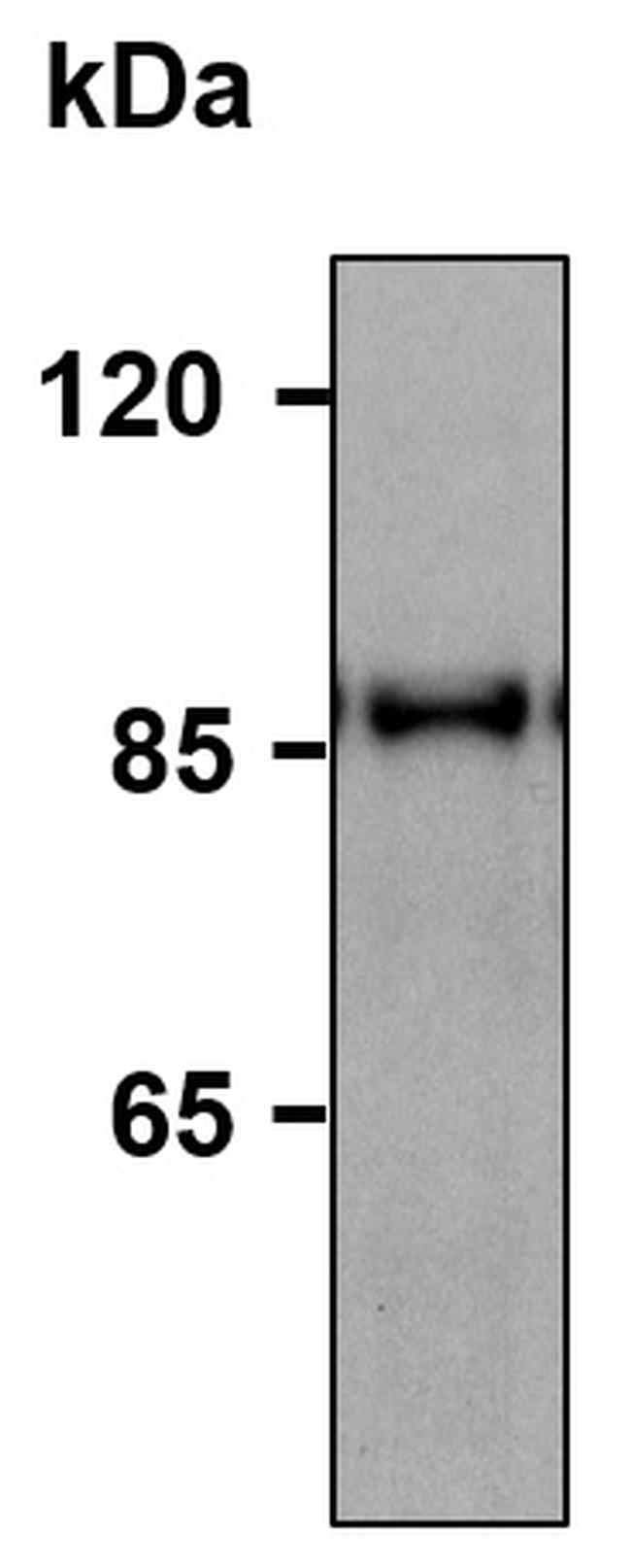 HELLS Antibody in Western Blot (WB)