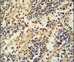 HEMK1 Antibody in Immunohistochemistry (IHC)