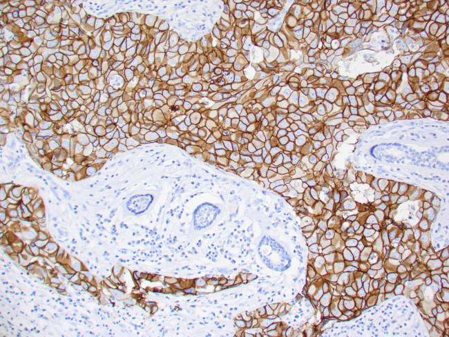 Her-2/neu Antibody in Immunohistochemistry (Paraffin) (IHC (P))