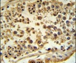 HFE Antibody in Immunohistochemistry (IHC)