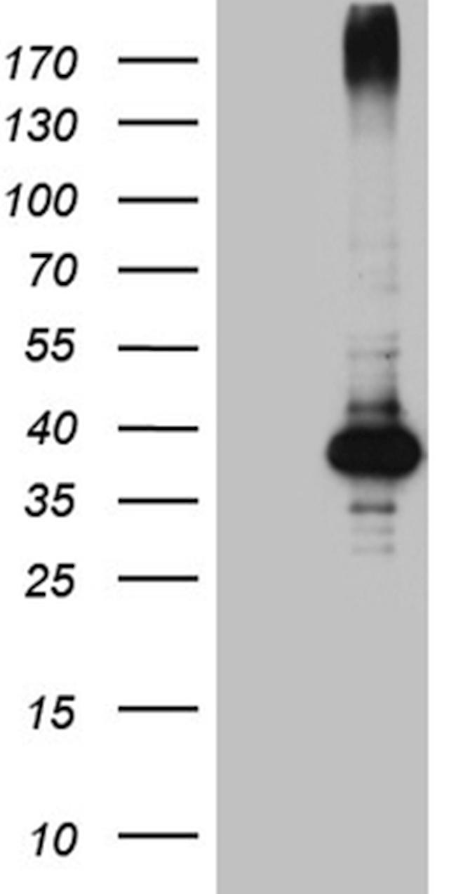 HFE2 Antibody in Western Blot (WB)