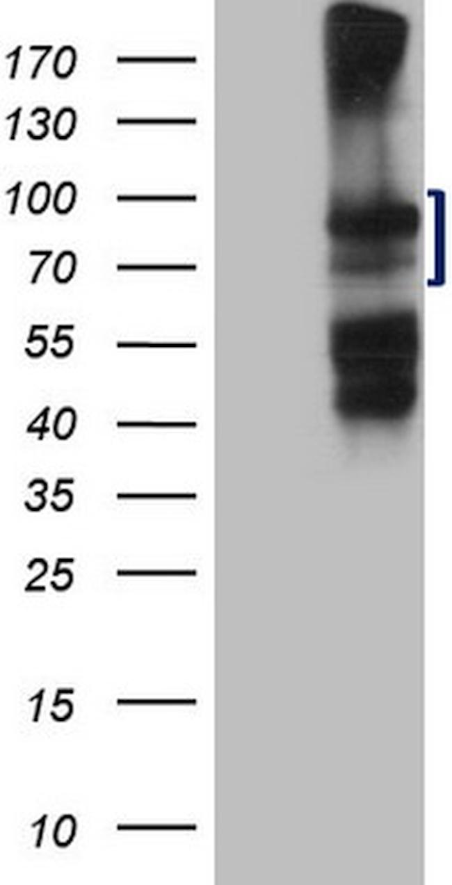 HGF Antibody in Western Blot (WB)