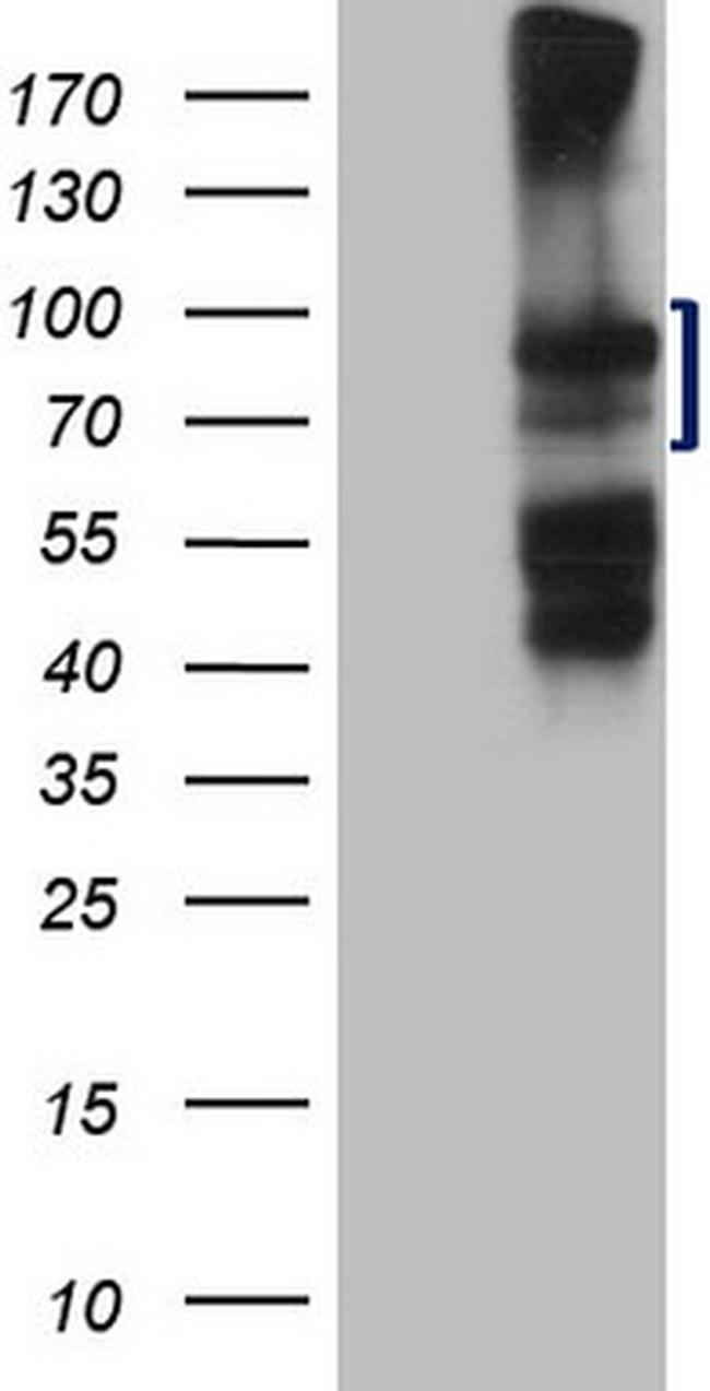 HGF Antibody in Western Blot (WB)