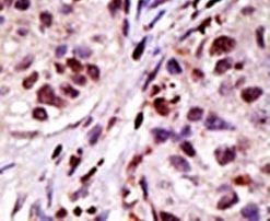HGS Antibody in Immunohistochemistry (IHC)