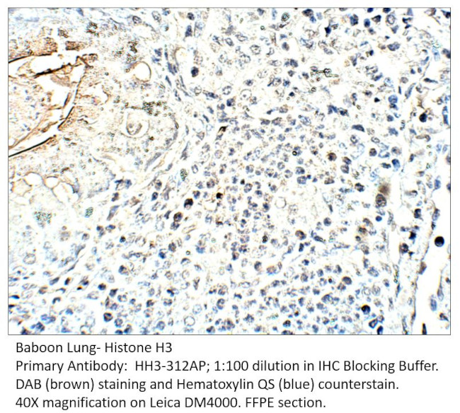 Histone H3 Antibody in Immunohistochemistry (IHC)