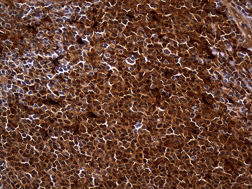 HHLA3 Antibody in Immunohistochemistry (Paraffin) (IHC (P))