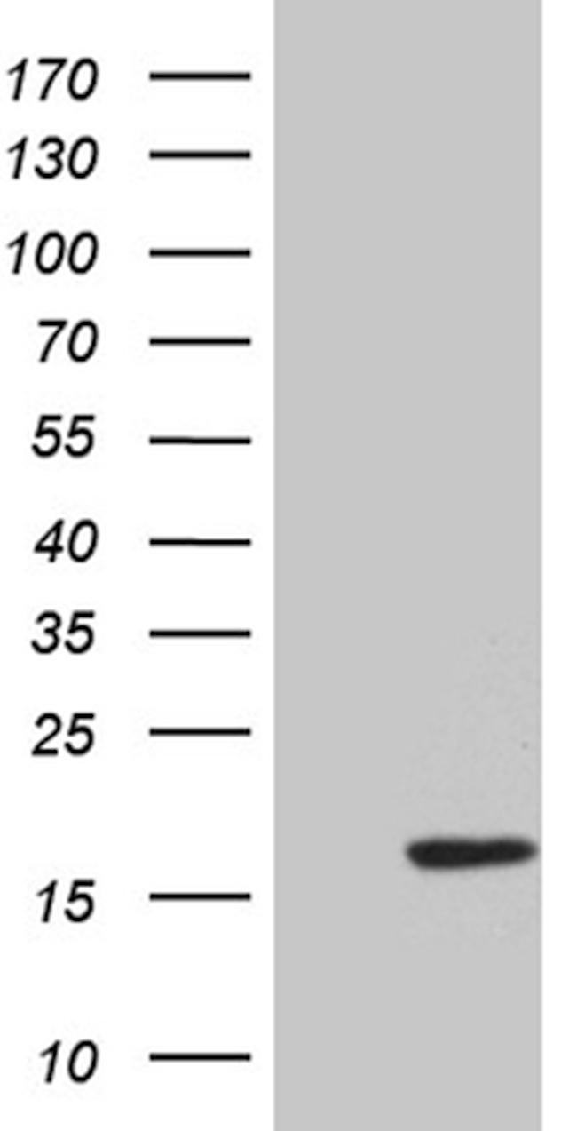 HHLA3 Antibody in Western Blot (WB)