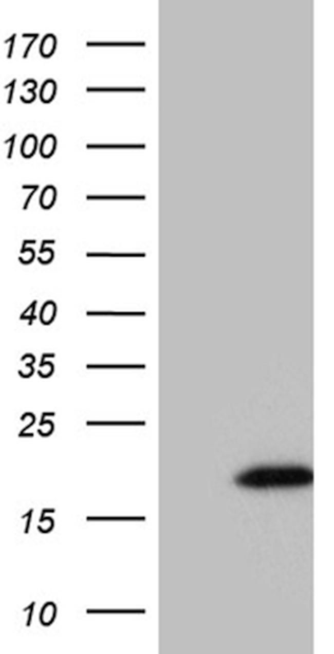 HHLA3 Antibody in Western Blot (WB)