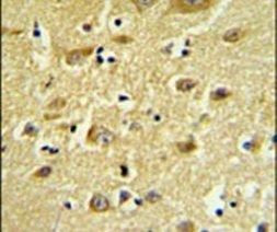 HIAT1 Antibody in Immunohistochemistry (IHC)