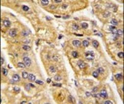 HIBCH Antibody in Immunohistochemistry (IHC)