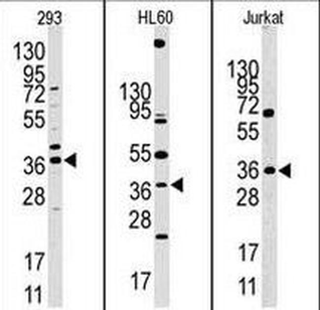 HIF1AN Antibody in Western Blot (WB)