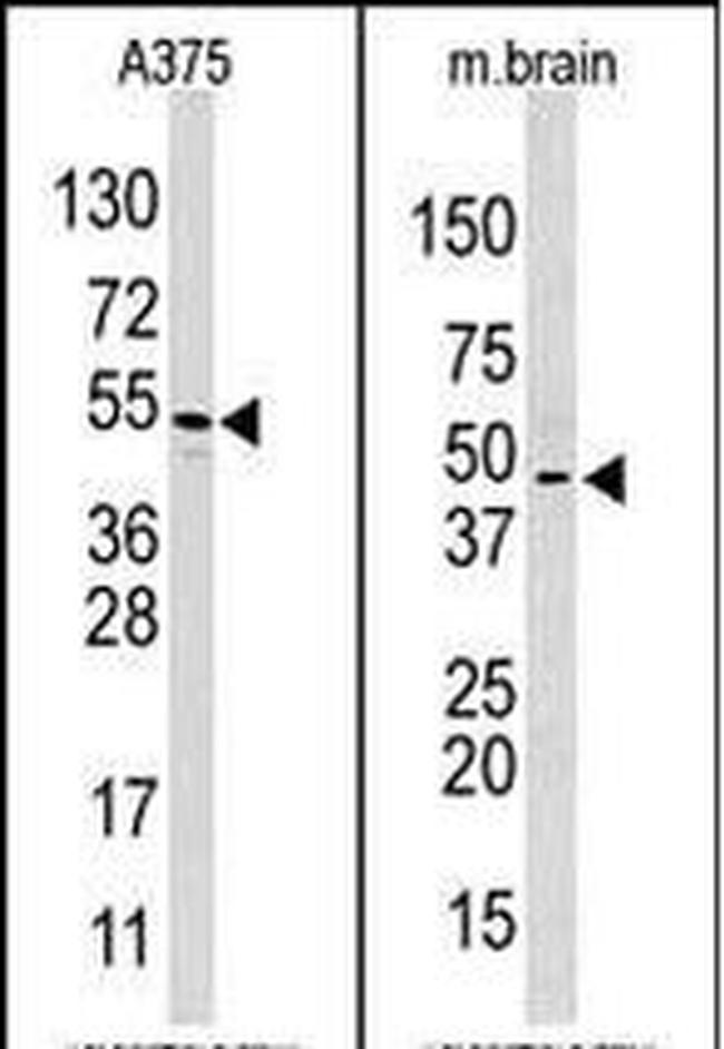 HIF1AN Antibody in Western Blot (WB)