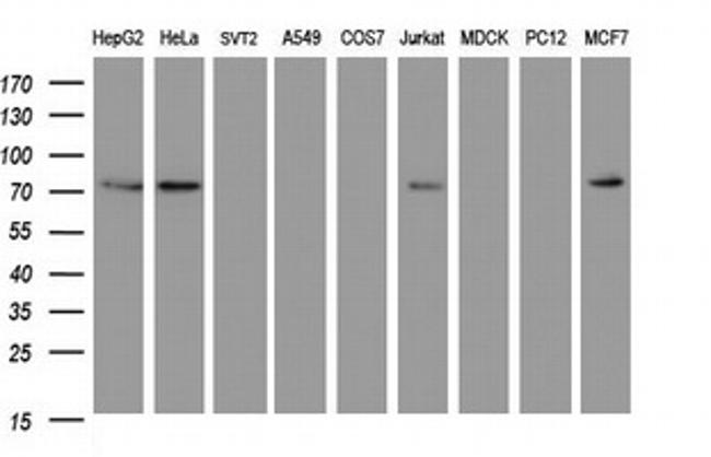 HIF3A Antibody in Western Blot (WB)